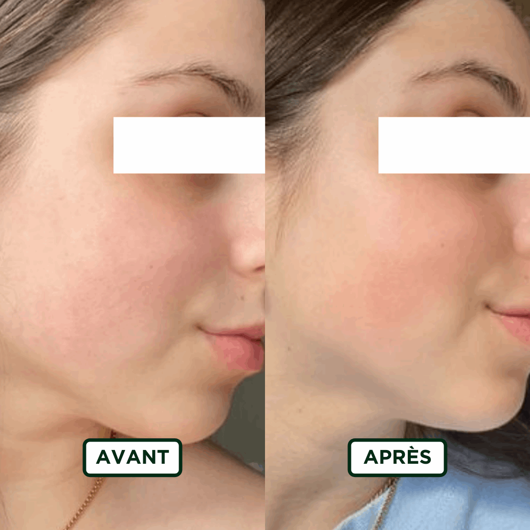 Crème de Nuit Hydratant - Sans amande