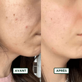 Crème de Nuit Hydratant - Sans amande