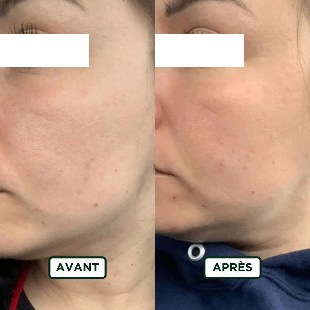 Crème de Nuit Hydratant