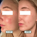 Crème de Nuit Hydratant - Sans amande
