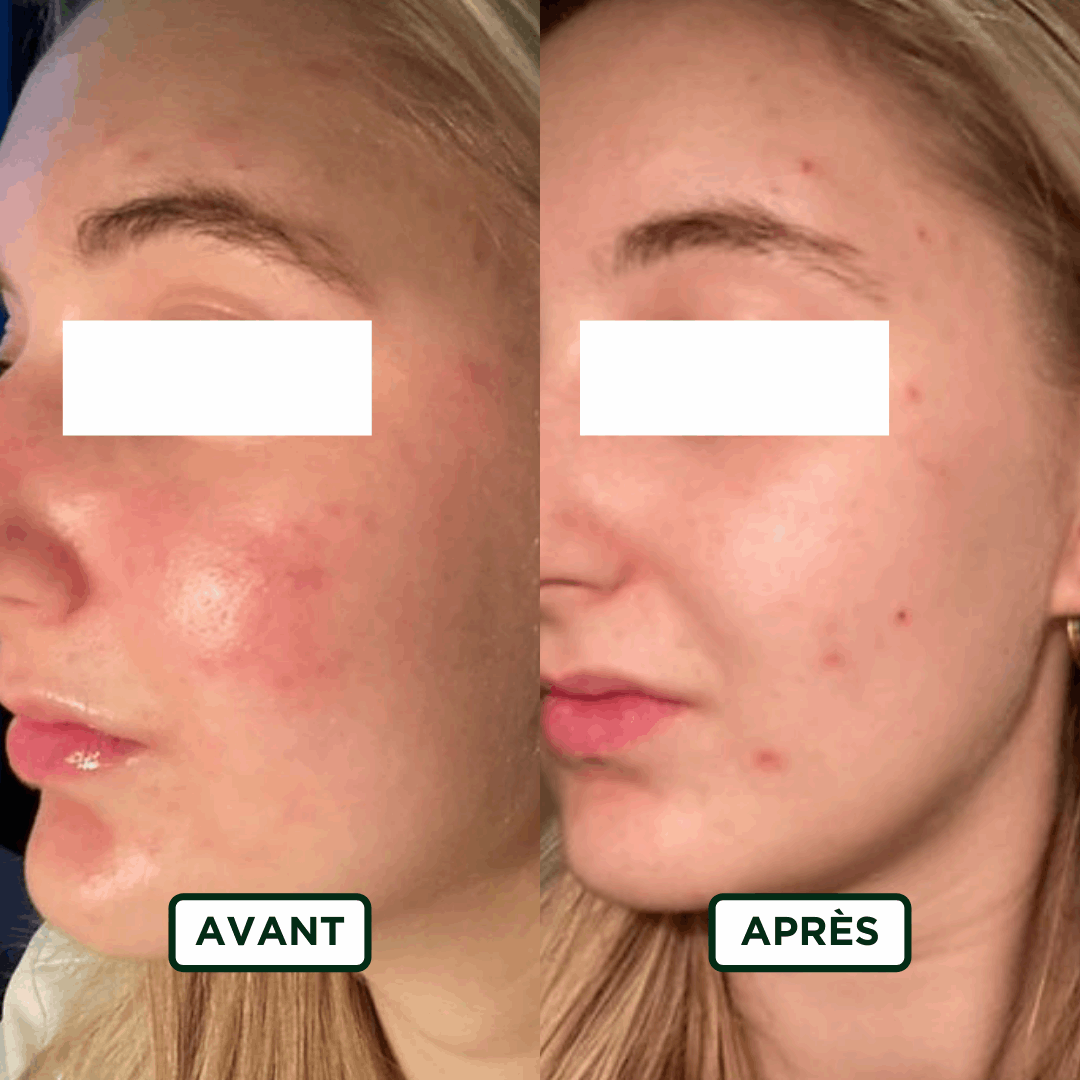 Crème de Nuit Hydratant - Sans amande